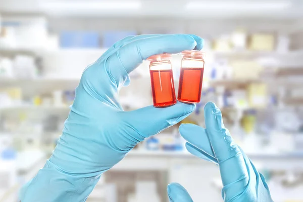 Two Hands Nitril Gloves Hold Red Liquid Samples Disposable Plastic — Stock Photo, Image