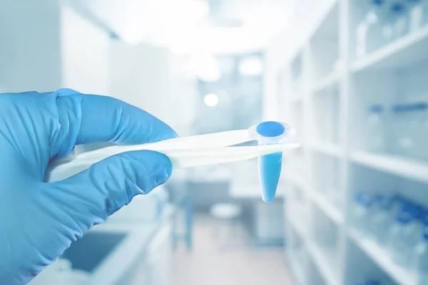 Mano Guante Protector Sostiene Muestra Líquida Azul Laboratorio Borroso Fondo — Foto de Stock