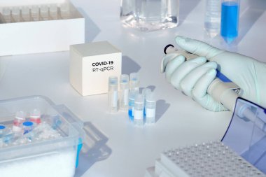 Quick novel coronavirus test kit. 2019 nCoV pcr diagnostics kit. Hand in glove with automatic pipette. RT-PCR kit to detect covid19 virus in clinical samples.  clipart