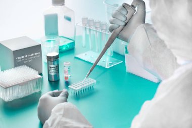 Romantik koronavirüs tespiti: COVID-19 'u olan hastaların kanında virüsün antikorlarını tespit etmek için SARS-COV-2 rna ve hızlı koronavirüs için pCR seti. Epidemiyoloji laboratuvarında..