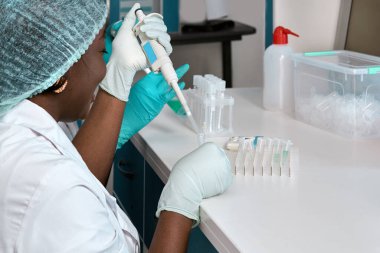 Afrikalı bilim adamları, laboratuvar önlüğü ve eldiven giyen teknik asistanlar veya mezunlar modern test laboratuvarında hasta örneklerini PCR testine tabi tutuyorlar. Covid-19 numuneleri için reaksiyonlar yapılıyor..