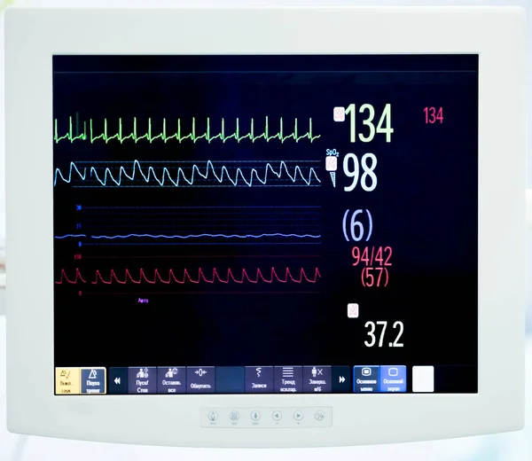 在手术期间心脏监测器 — 图库照片