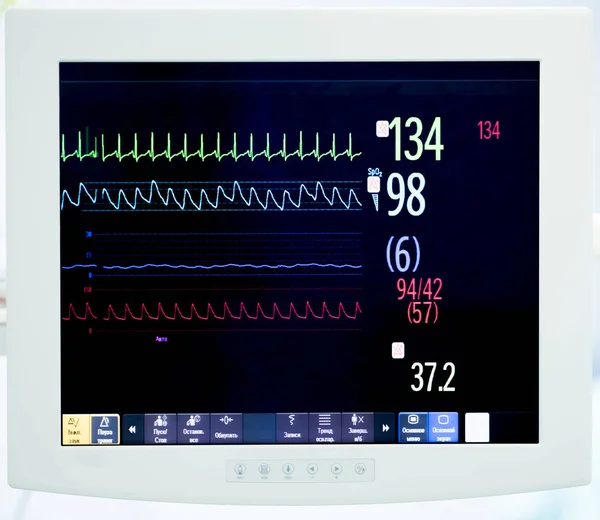 Monitor cardíaco durante la cirugía — Foto de Stock