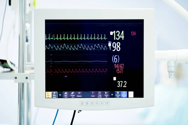 Monitor cardíaco durante a cirurgia — Fotografia de Stock