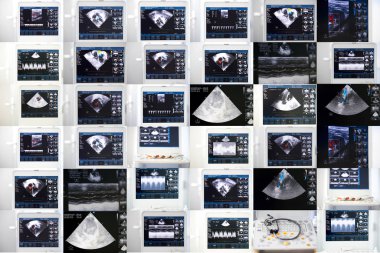 a collage of images of ultrasound machine clipart