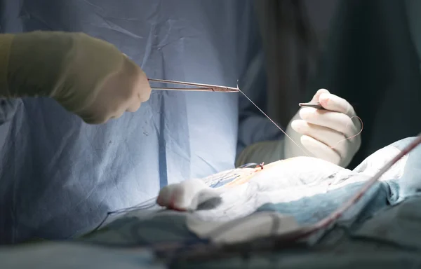 steril eldiven iğne cerrahlarından dikilmiş yarayı kelepçe