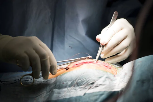 Kirurger i sterila handskar nålen klämma sys såret — Stockfoto