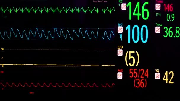 EKG monitor v provozu místnosti — Stock video