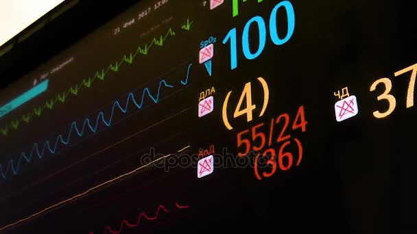 Monitor ECG en sala de operaciones — Vídeo de stock