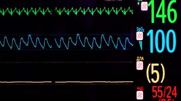 Ecg Monitor im Operationssaal — Stockvideo