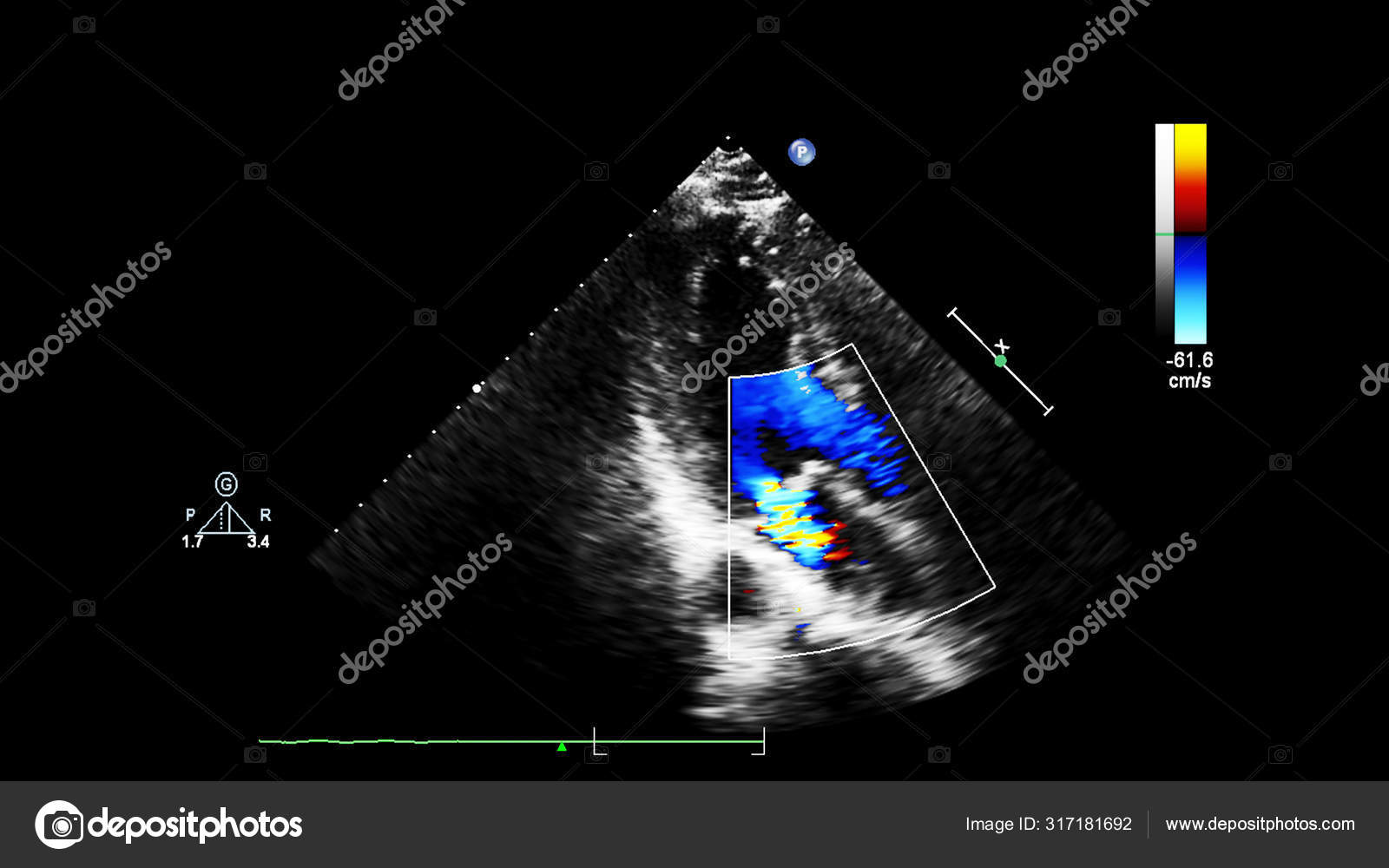 Screen of echocardiography (ultrasound) machine. Stock Photo by