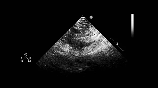 Pantalla de la máquina de ecocardiografía (ultrasonido) . —  Fotos de Stock