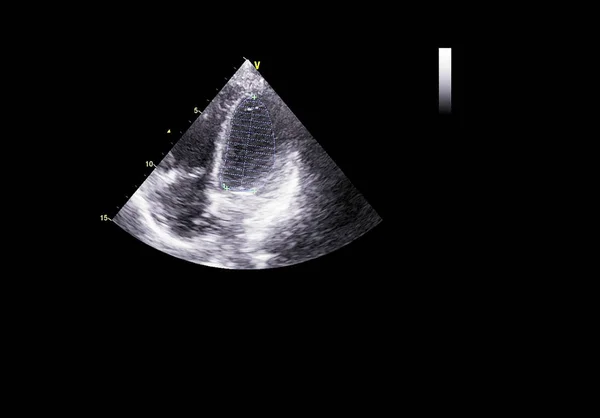 Tela da máquina de ecocardiografia (ultra-som) . — Fotografia de Stock