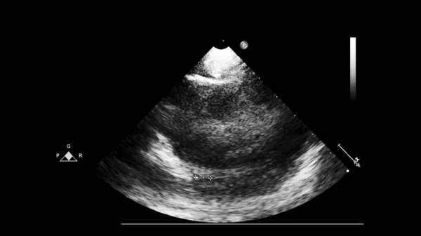 Pantalla de la máquina de ecocardiografía (ultrasonido) . —  Fotos de Stock