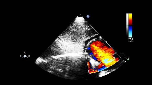 Scherm van echocardiografie (echografie) machine. — Stockfoto