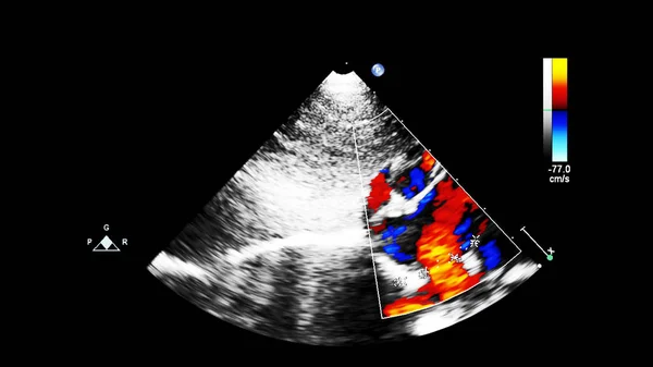 Screen of echocardiography (ultrasound) machine. — Stock Photo, Image