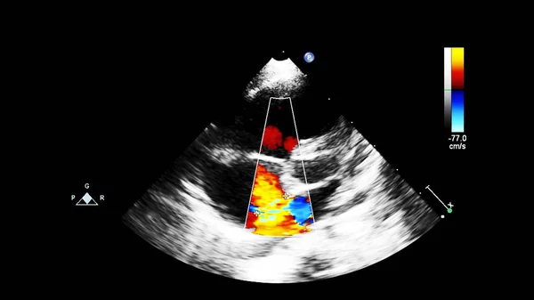 Pantalla de la máquina de ecocardiografía (ultrasonido) . —  Fotos de Stock