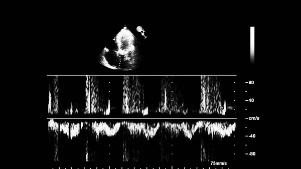 Pantalla de la máquina de ecocardiografía (ultrasonido) . —  Fotos de Stock