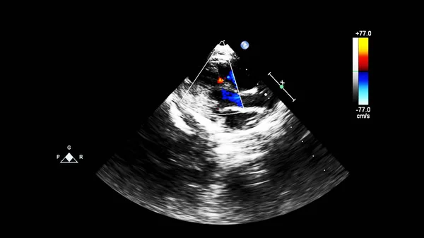 Tela da máquina de ecocardiografia (ultra-som) . — Fotografia de Stock