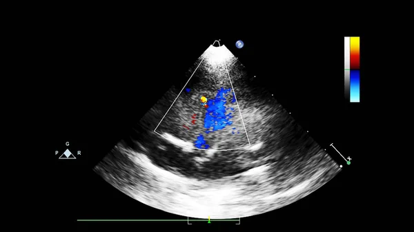 Screen of echocardiography (ultrasound) machine. — Stock Photo, Image