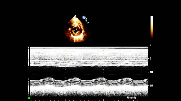 Bildschirm der Echokardiographie (Ultraschall) Maschine. — Stockfoto