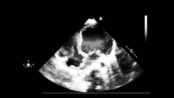Obrazovka počítače s echokardiografií (ultrazvukem). — Stock fotografie