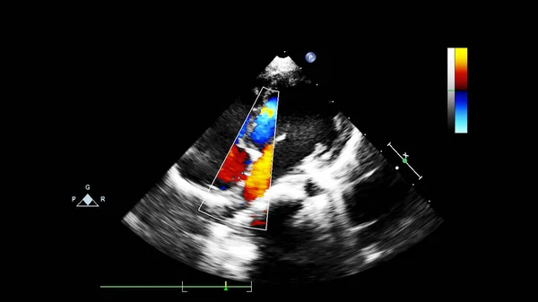 Tela da máquina de ecocardiografia (ultra-som) . — Fotografia de Stock