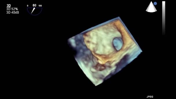 Hoge Kwaliteit Video Echografie Transslokdarmonderzoek Van Het Hart — Stockvideo