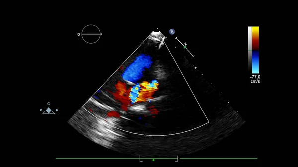 Pantalla de la máquina de ecocardiografía (ultrasonido) . — Foto de Stock