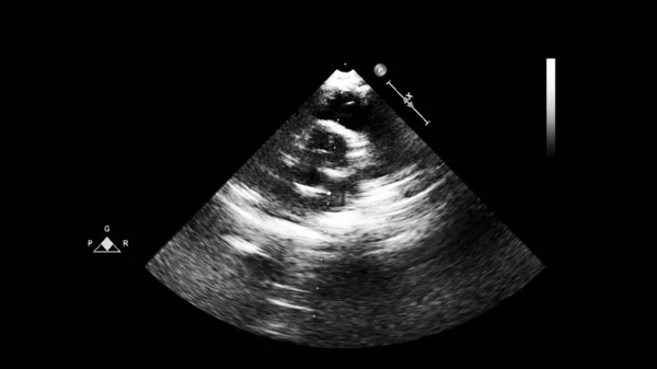 Tela da máquina de ecocardiografia (ultra-som) . — Fotografia de Stock