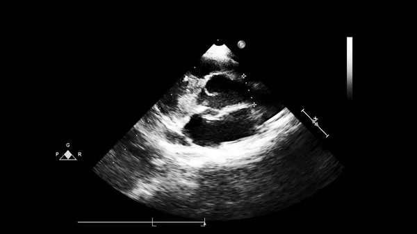 Pantalla de la máquina de ecocardiografía (ultrasonido) . —  Fotos de Stock