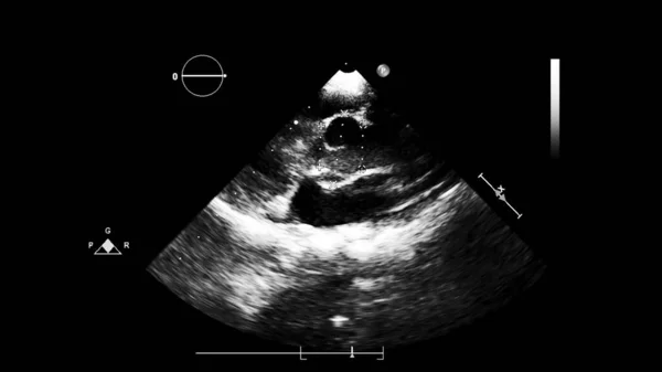 Pantalla de la máquina de ecocardiografía (ultrasonido) . —  Fotos de Stock