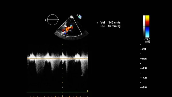 超声心动图（超声）机屏幕. — 图库照片