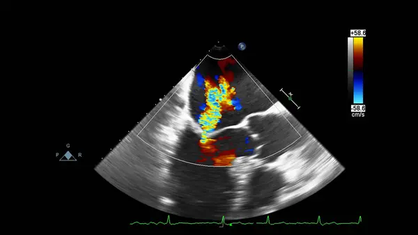 Écran de la machine d'échocardiographie (échographie) . — Photo