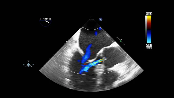 Écran de la machine d'échocardiographie (échographie) . — Photo