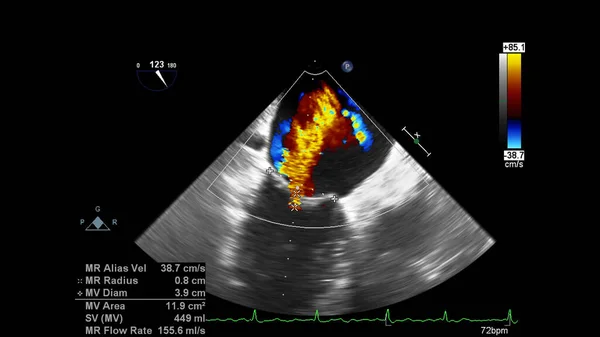 超声心动图（超声）机屏幕. — 图库照片