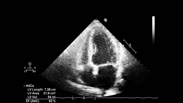 Tela da máquina de ecocardiografia (ultra-som) . — Fotografia de Stock