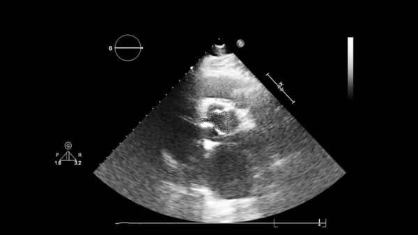 Tela da máquina de ecocardiografia (ultra-som) . — Fotografia de Stock