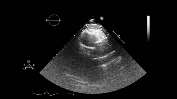 Bildschirm der Echokardiographie (Ultraschall) Maschine. — Stockfoto