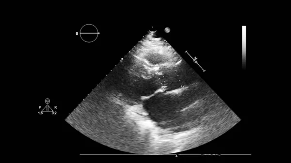 Ekokardiyografi (ultrason) makinesi nin ekranı. — Stok fotoğraf