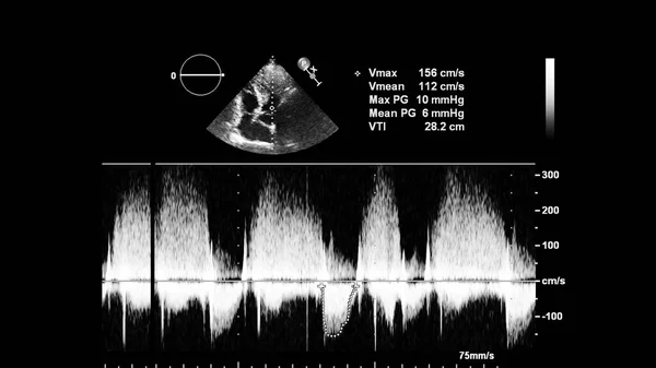 Ekran echokardiografii (USG) maszyny. — Zdjęcie stockowe