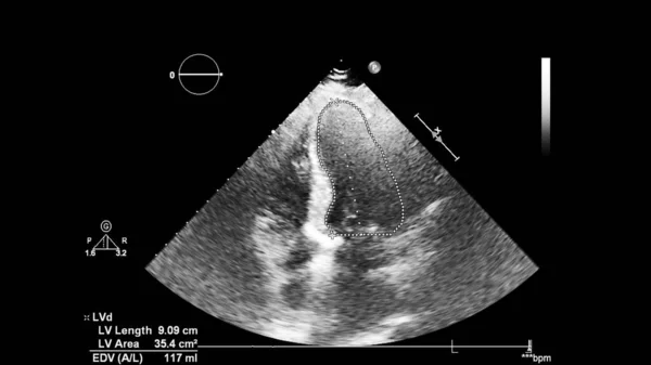 Écran de la machine d'échocardiographie (échographie) . — Photo