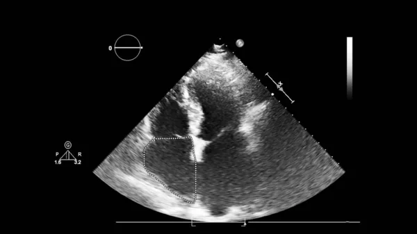 Pantalla de la máquina de ecocardiografía (ultrasonido) . —  Fotos de Stock