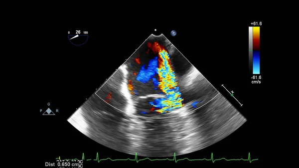 Tela da máquina de ecocardiografia (ultra-som) . — Fotografia de Stock