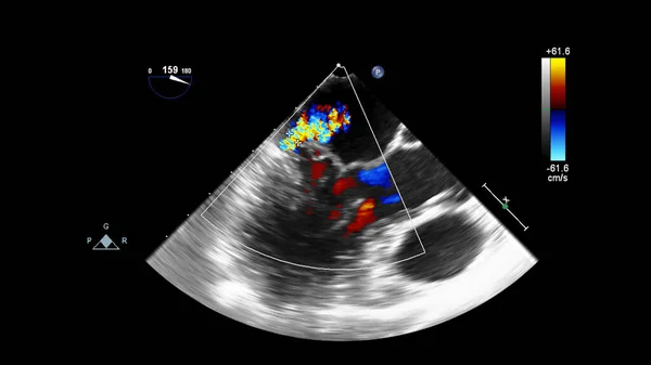 Scherm van echocardiografie (echografie) machine. — Stockfoto