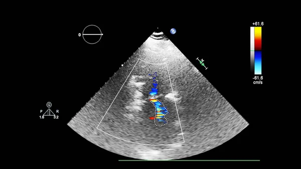 心エコー検査(超音波)マシンの画面. — ストック写真