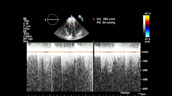 Ekokardiyografi (ultrason) makinesi nin ekranı. — Stok fotoğraf