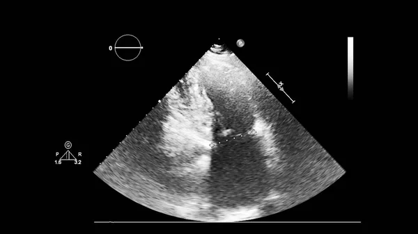 Écran de la machine d'échocardiographie (échographie) . — Photo