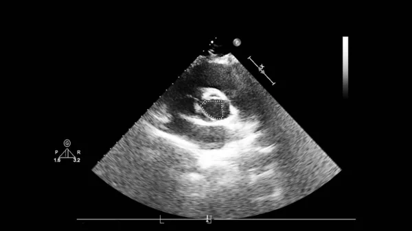 Scherm van een ultrasone machine met een hart beeld. — Stockfoto