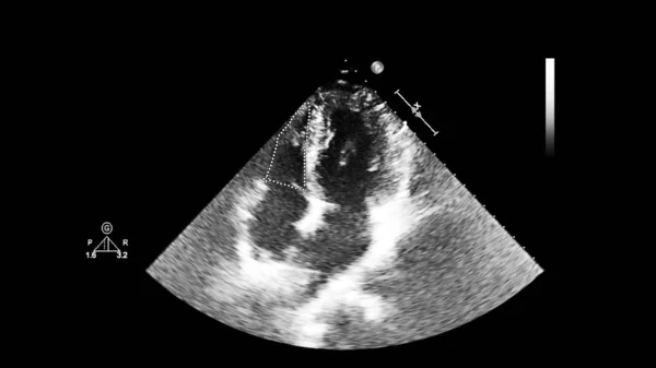 Écran d'une machine à ultrasons avec une image cardiaque . — Photo